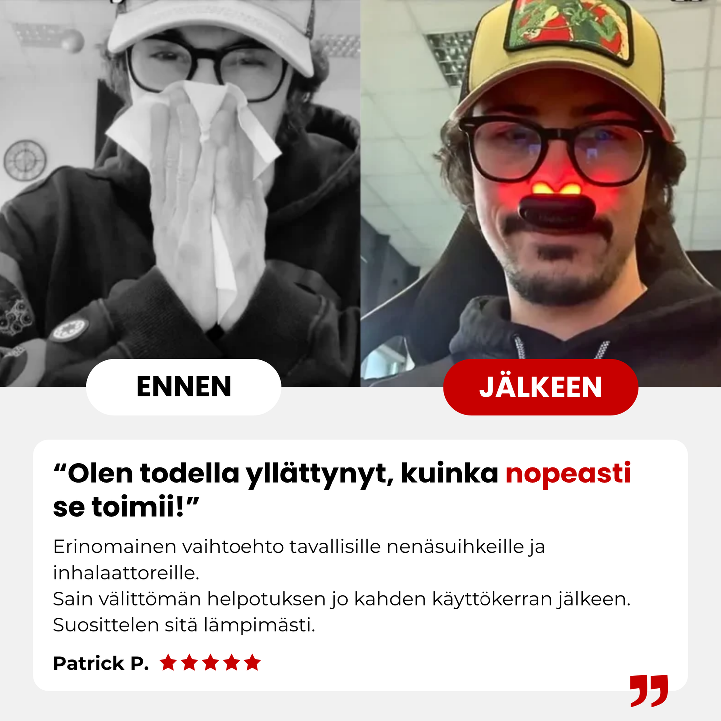 NoMore® - Nenän Punavalohoito